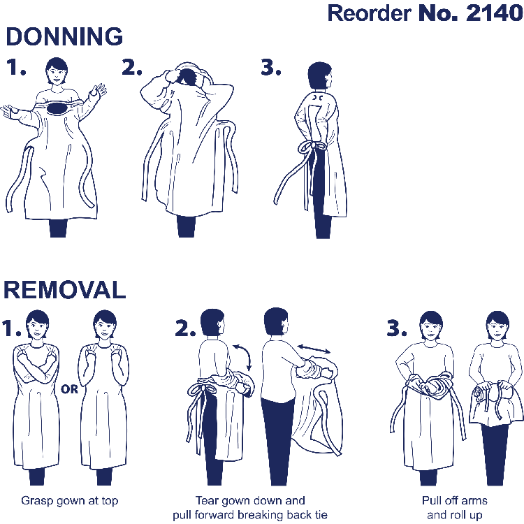 Dynarex CPE Thumb Loop Isolation Gown, Blue - 15ea/bx, 5bxs/case (75 Count)